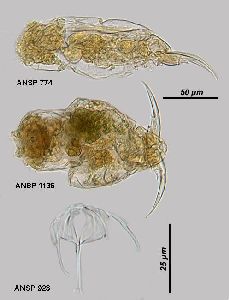  Image courtesy of ANSP (Jersabek et al. 2003) <a href='../../Reference/Index/15798' target='_blank'>[Ref.15798]</a>; females, ventral (1136) and lateral (774) views, and trophi (923 ventral view)